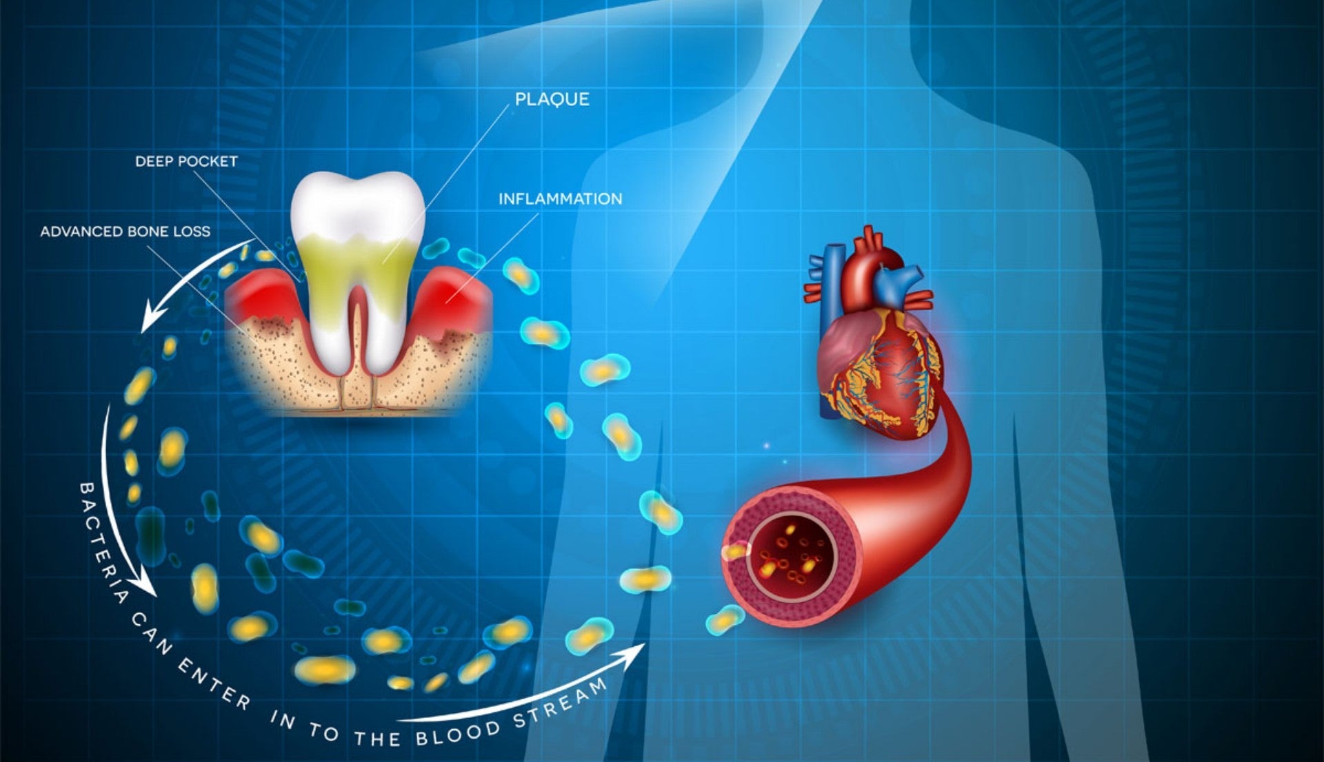 Why is Gum Disease Linked to the Heart? The Connection You Can’t Afford to Ignore